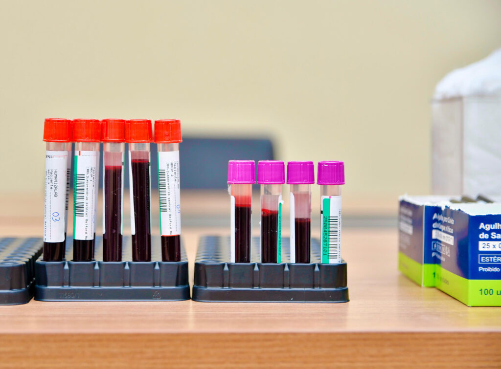 Prefeitura de Belford Roxo inicia campanha do Novembro Azul com ações, serviços e exames médicos para os servidores municipais